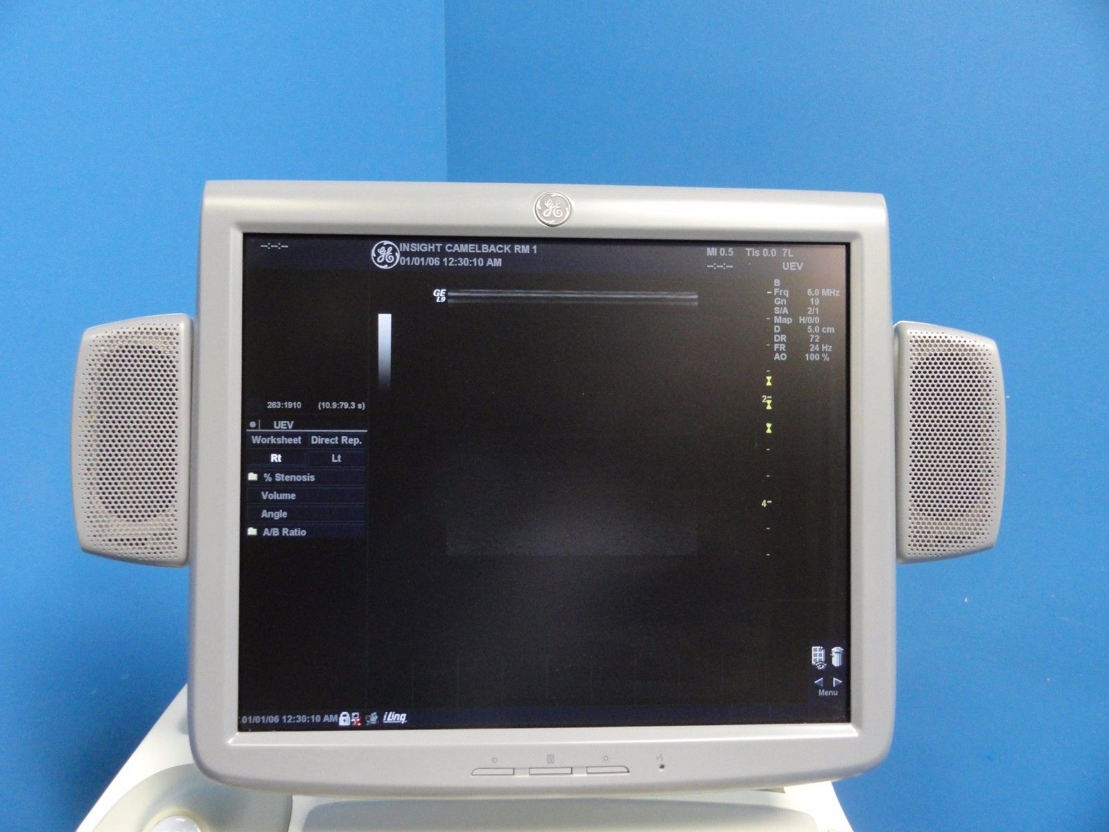 GE Logiq 9 LCD Ultrasound System W/ M12L, 7L, 4C, 4D3C-L Probes & Printer 10369 DIAGNOSTIC ULTRASOUND MACHINES FOR SALE