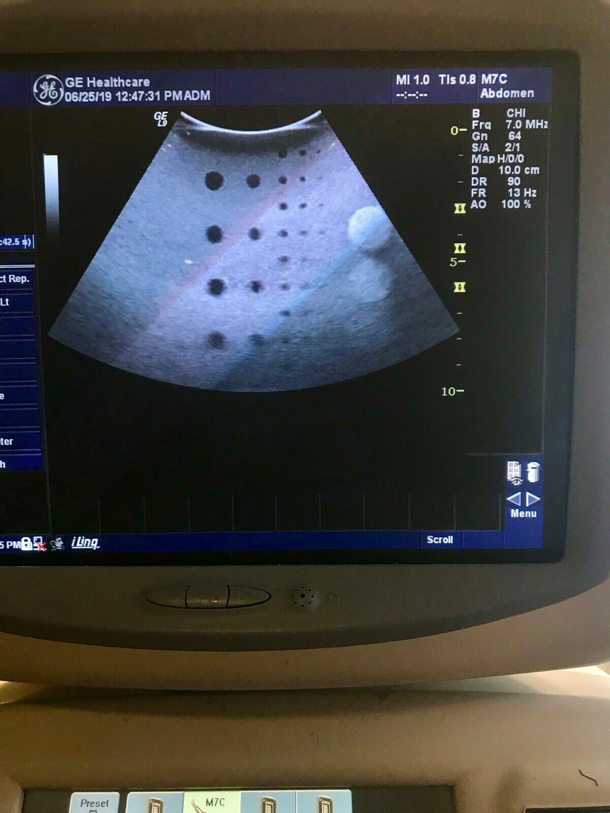 GE M7C Curved Array Ultrasound Transducer Probe DIAGNOSTIC ULTRASOUND MACHINES FOR SALE