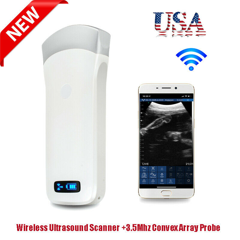 DigtalPortable WIFI Wireless Ultrasound Scanner Machine+3.5Mhz ConvexArray Probe DIAGNOSTIC ULTRASOUND MACHINES FOR SALE