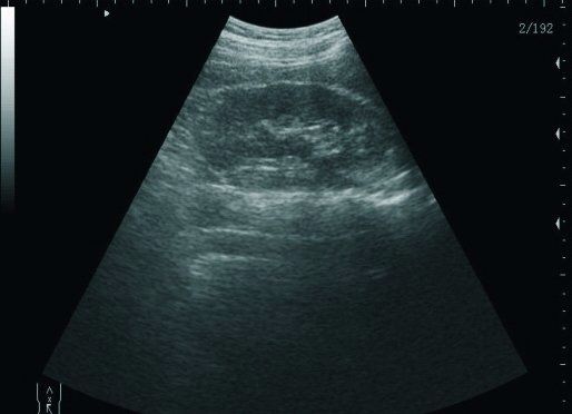 Laptop Digital  Ultrasound scanner with Transvaginal probe,+3D With Box CE A+ 190891499356 DIAGNOSTIC ULTRASOUND MACHINES FOR SALE