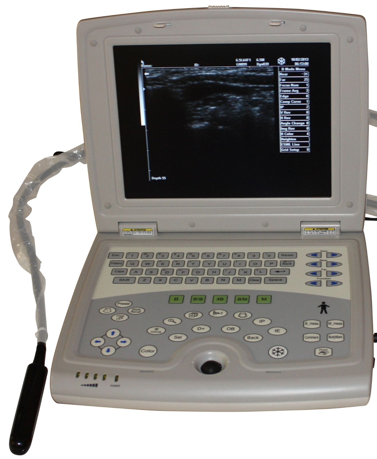 Veterinary Laptop Ultrasound Scanner 10" LCD & Rectal Probe - USA Warranty Deal DIAGNOSTIC ULTRASOUND MACHINES FOR SALE