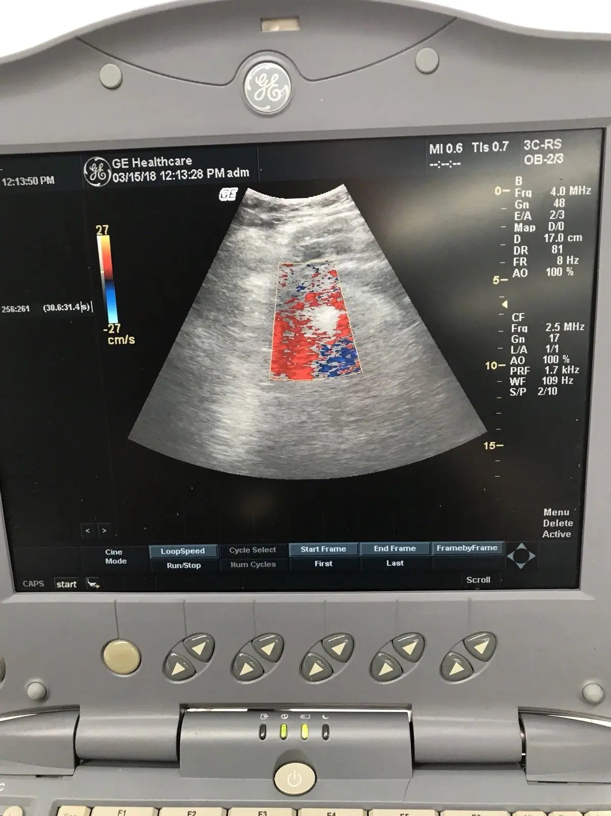 GE Logiq Book XP with 2 x Ultrasound Probes. Linear and Convex 2011 DIAGNOSTIC ULTRASOUND MACHINES FOR SALE