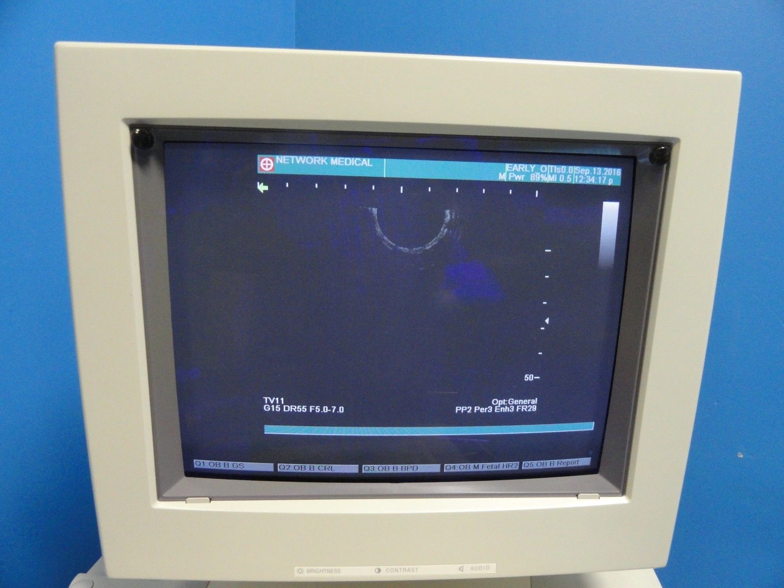 SHIMADZU TV11R-055U Transvaginal Probe For SDU-350/450 SDU-1100/1200/2200(10971) DIAGNOSTIC ULTRASOUND MACHINES FOR SALE