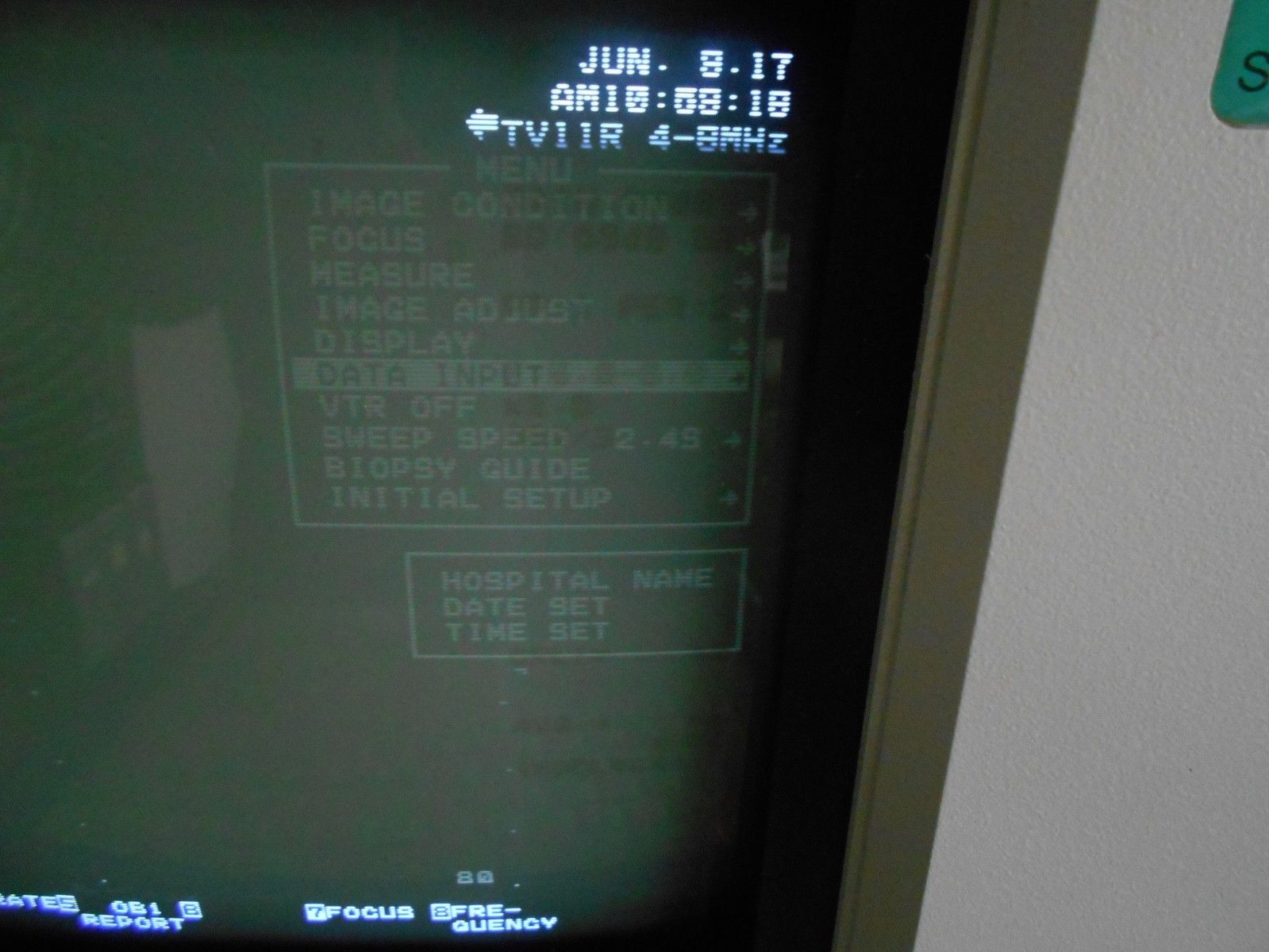 SHIMADZU SDU-350 XL Ultrasound With 2 Probes - Damaged - Turned On* DIAGNOSTIC ULTRASOUND MACHINES FOR SALE