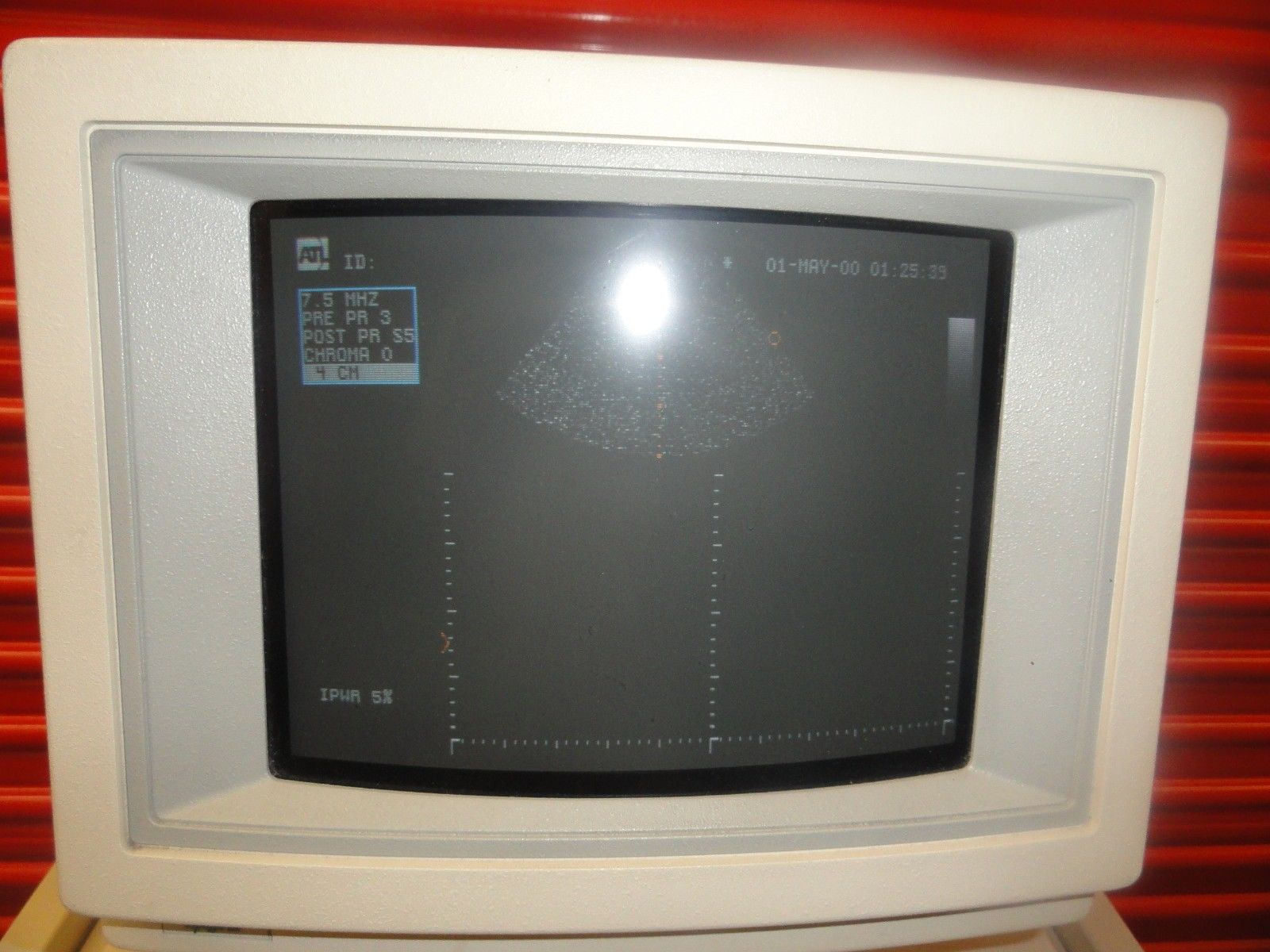 INTERSPEC ATL APOGEE CX ULTRASOUND SYSTEM W/ 7.5 SPA & ACL1547 PROBES  (5828 ) DIAGNOSTIC ULTRASOUND MACHINES FOR SALE