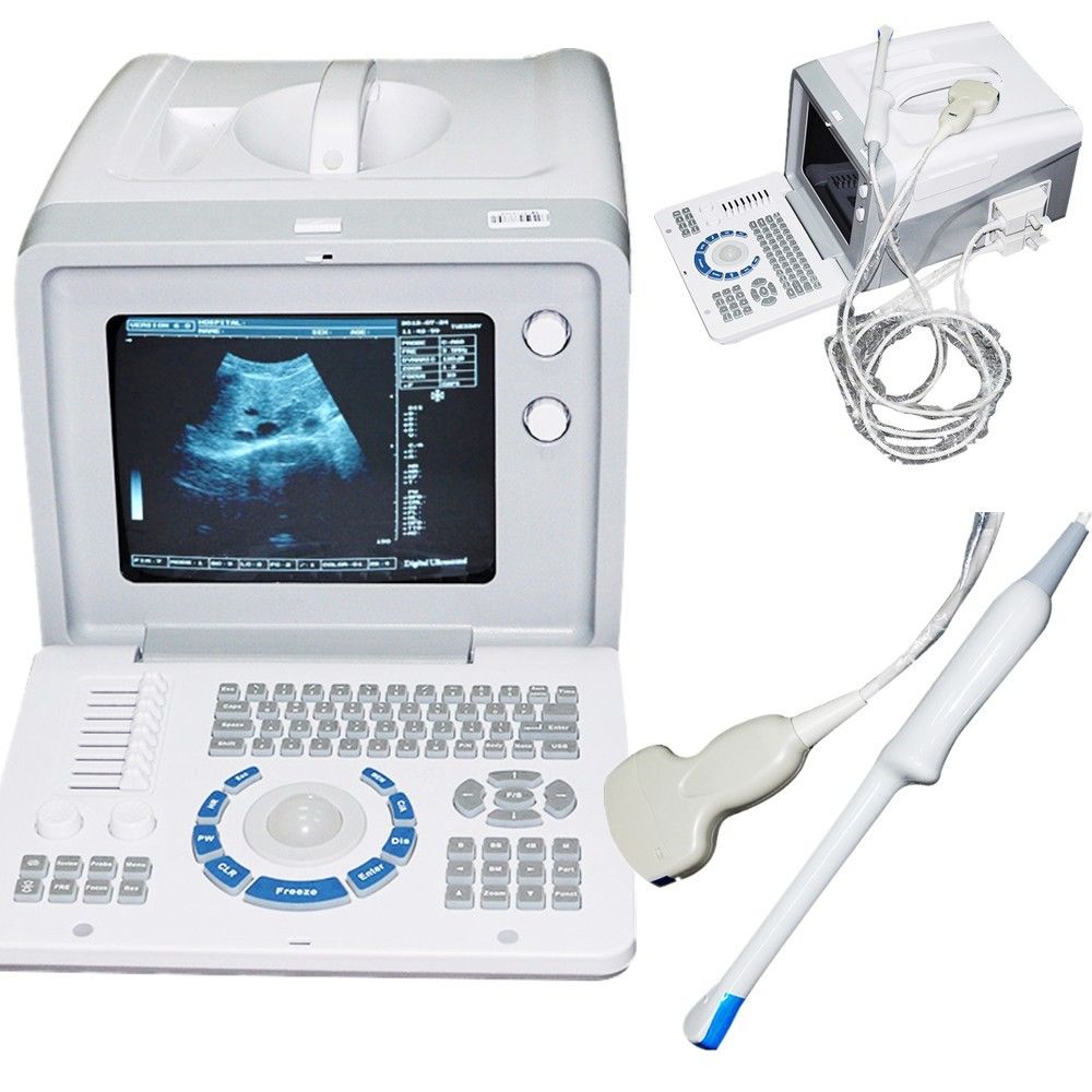 Digital Ultrasound machine Scanner  Convex + linear Probe +3D Worksation CE Sale 190891802941 DIAGNOSTIC ULTRASOUND MACHINES FOR SALE