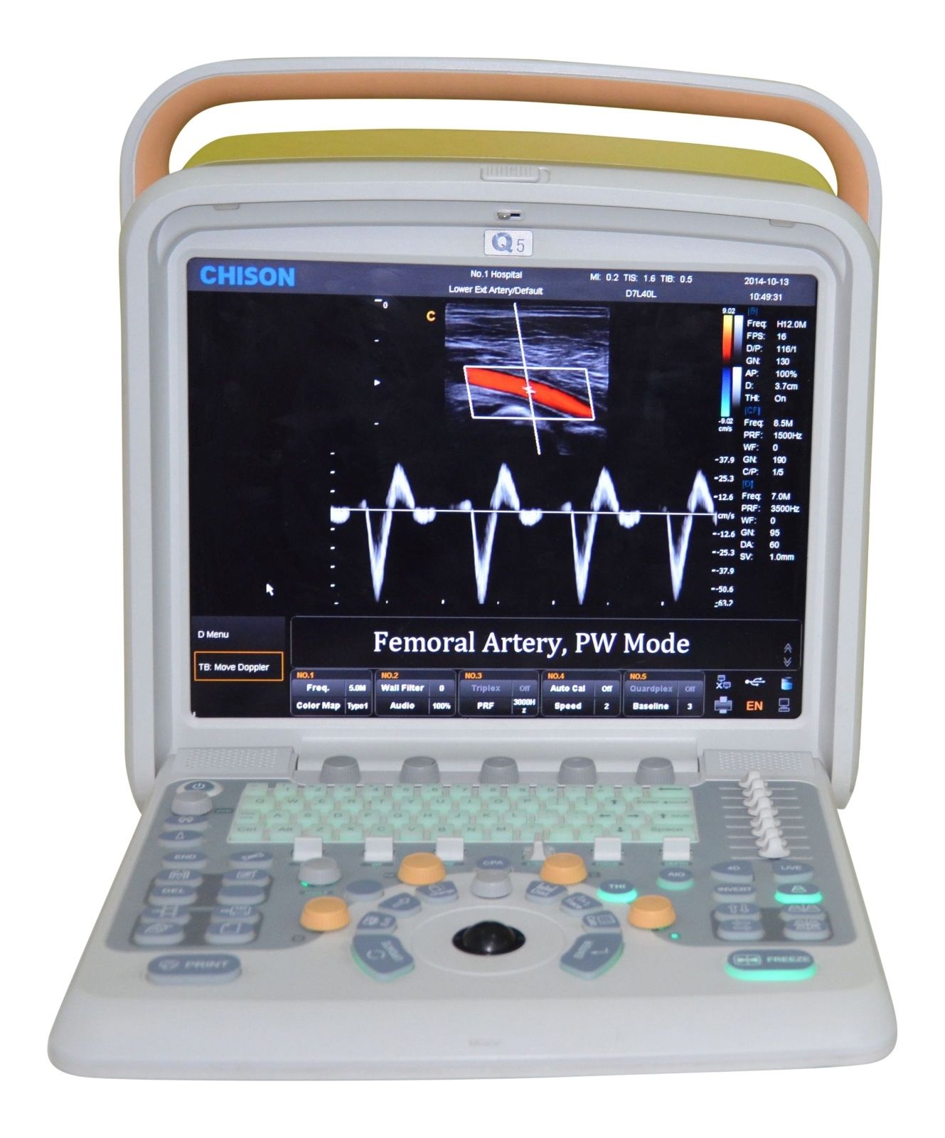 Veterinary Ultrasound Scanner with Two probes - Color Doppler Chison Q5Vet DIAGNOSTIC ULTRASOUND MACHINES FOR SALE