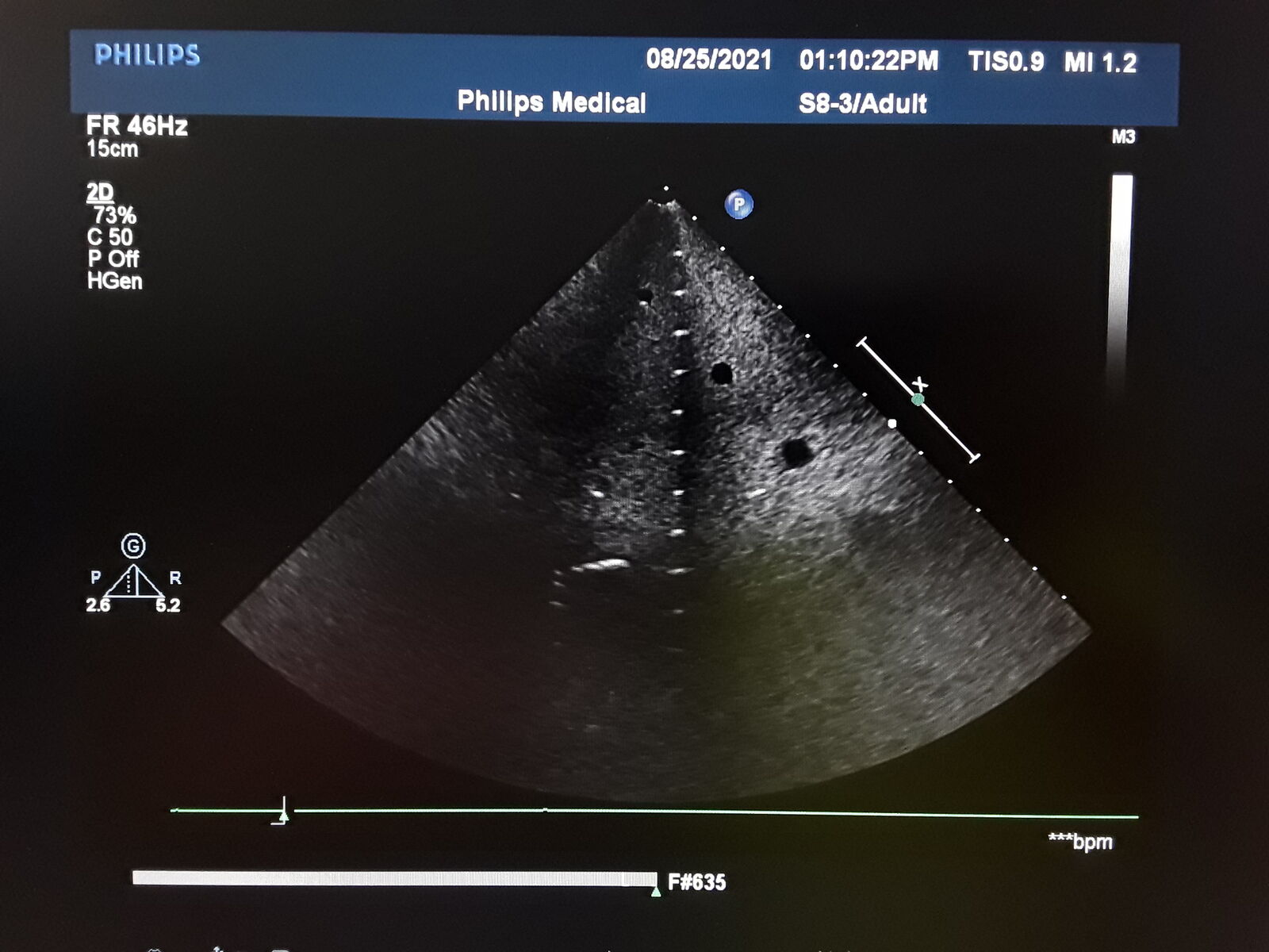 Philips Healthcare S8-3 Cardiac Sector Ultrasound Probe DIAGNOSTIC ULTRASOUND MACHINES FOR SALE