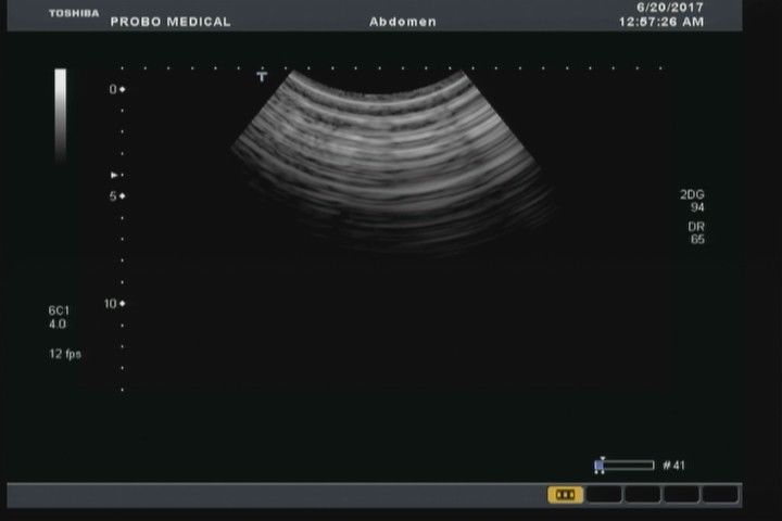 Toshiba PVT-382BT Ultrasound Probe DIAGNOSTIC ULTRASOUND MACHINES FOR SALE