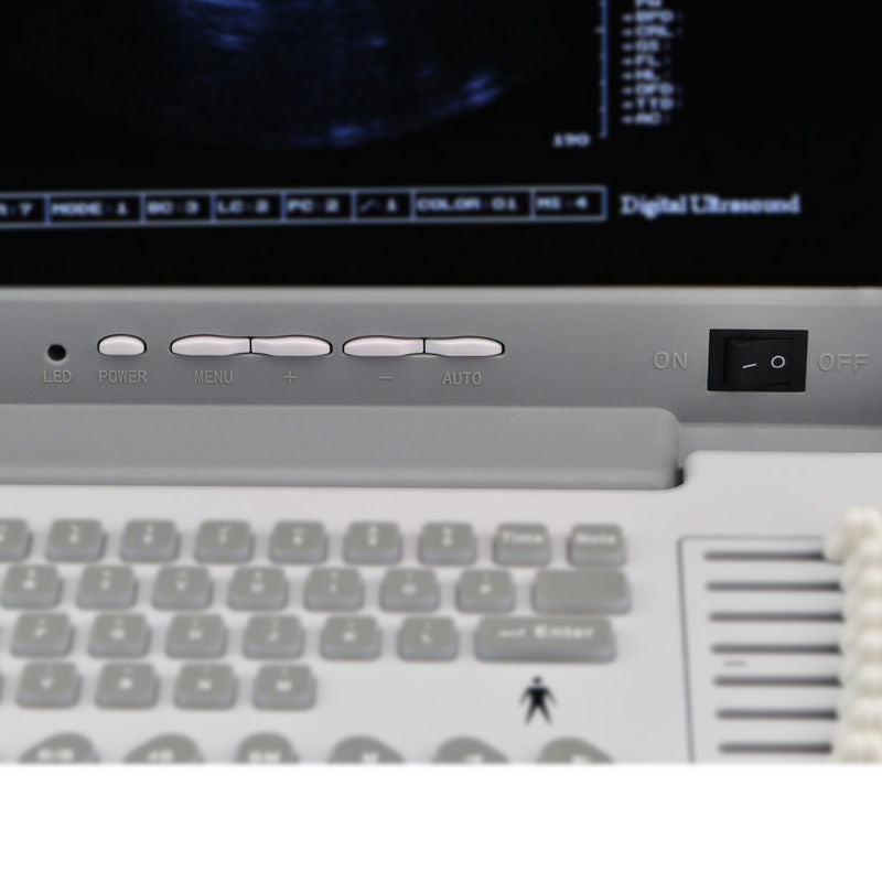 Human Used Ultrasound Scanner &Ultrasound Machine Portable+Micro Convex probe $ DIAGNOSTIC ULTRASOUND MACHINES FOR SALE