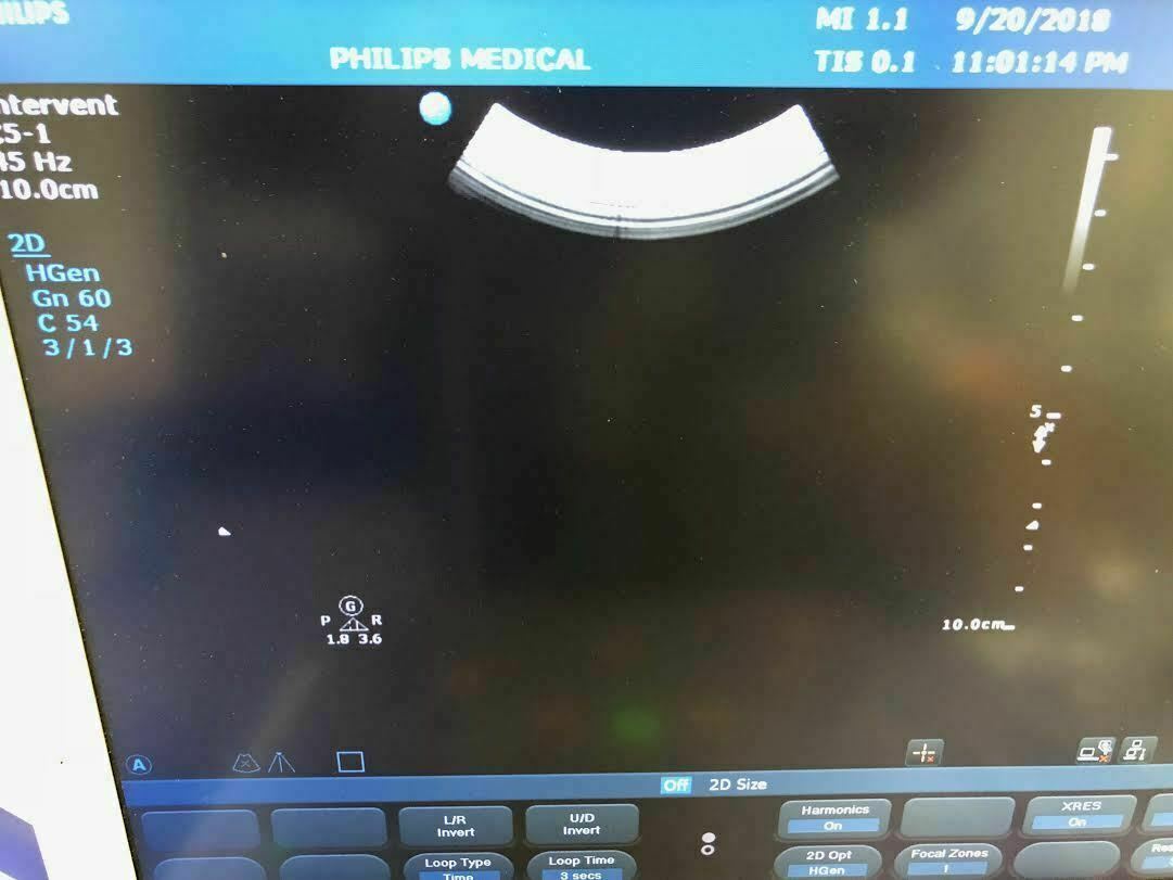 Philips CX50 Portable Ultrasound Machine (Probes / Transducers Available) DIAGNOSTIC ULTRASOUND MACHINES FOR SALE