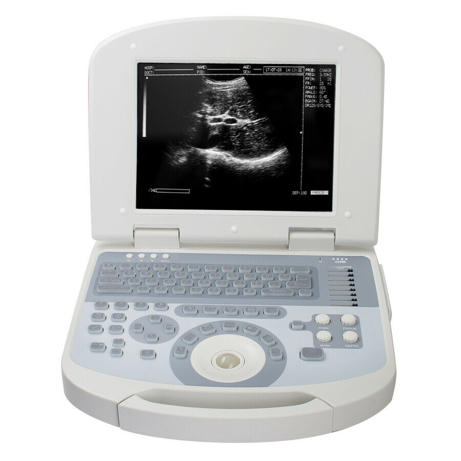 Digital Medical Ultrasound Scanner +3.5MHZ Convex Probe with 3D Software DIAGNOSTIC ULTRASOUND MACHINES FOR SALE