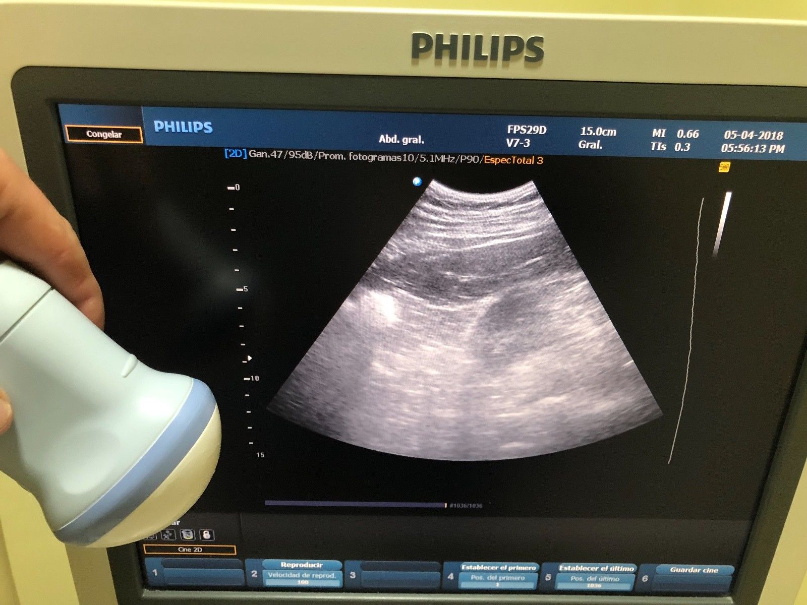 PHILIPS V7-3 4D CONVEX PROBE FOR HD9 DIAGNOSTIC ULTRASOUND MACHINES FOR SALE