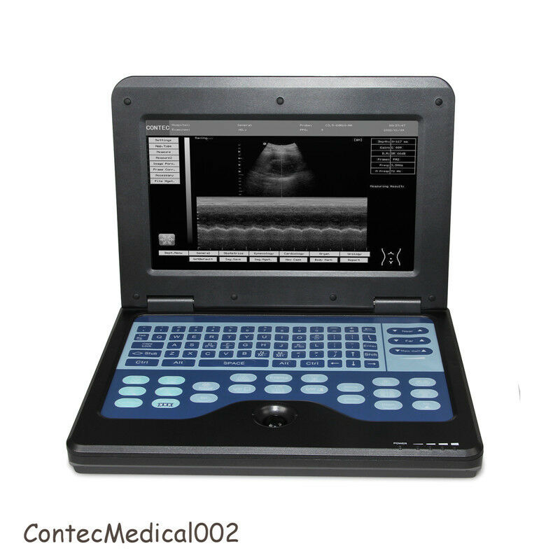 Portable Ultrasound Scanner Machine diagnostic sonography obstetric image 10.1 " DIAGNOSTIC ULTRASOUND MACHINES FOR SALE