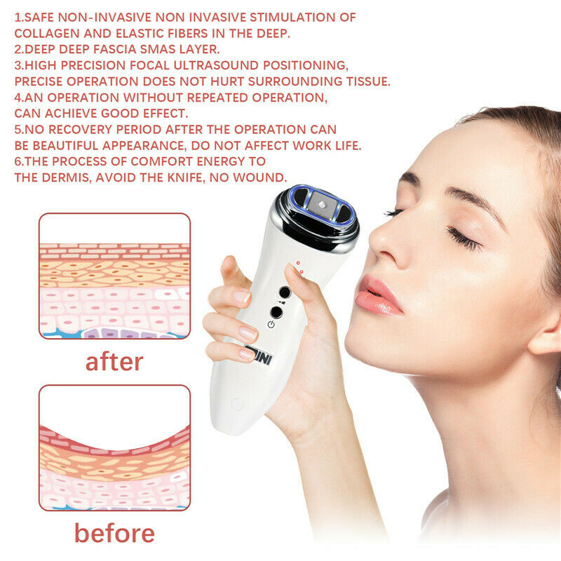 Mini Hifu Ultrasound Machine Face Lifting Skin Tighten Wrinkle Reduction Facial DIAGNOSTIC ULTRASOUND MACHINES FOR SALE