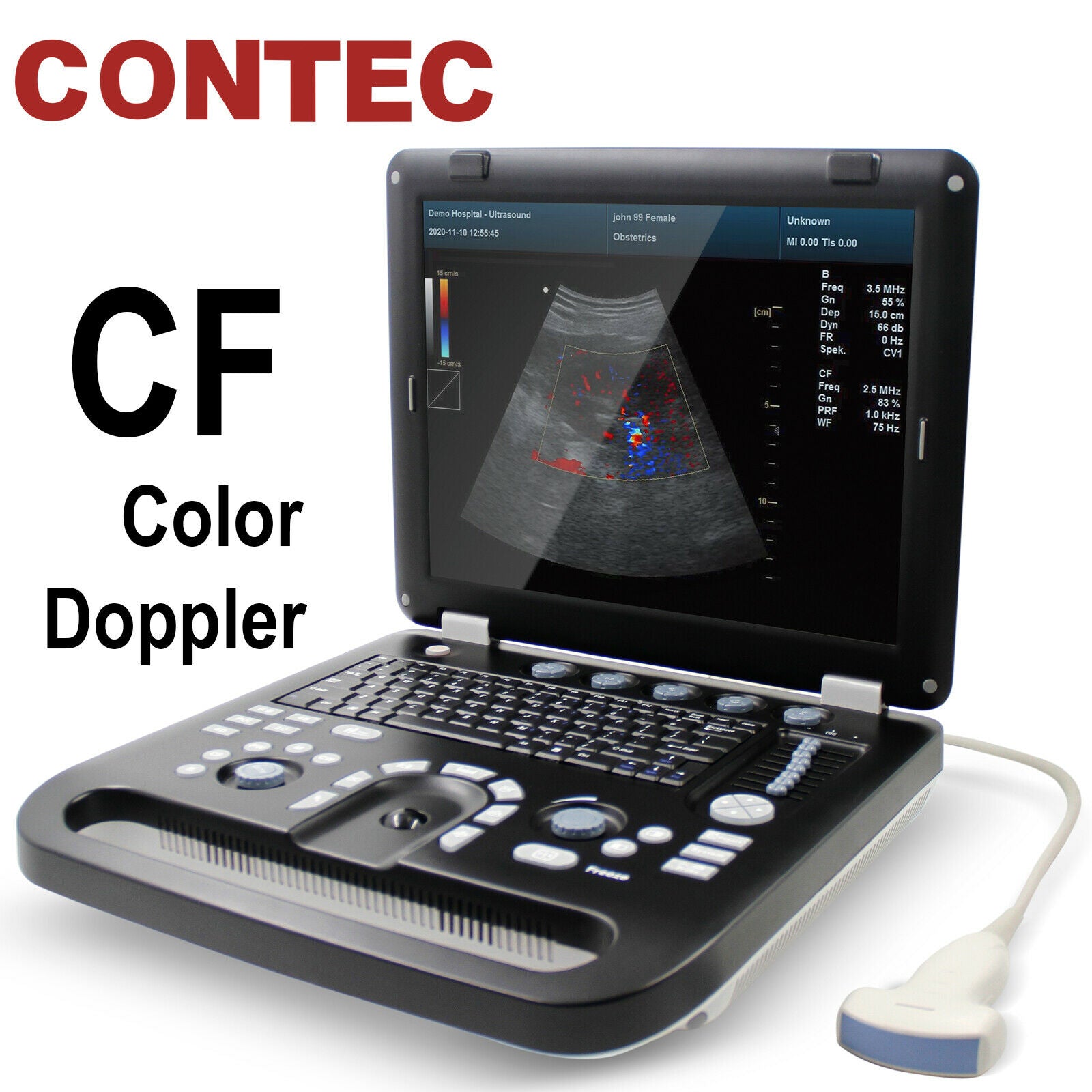 Color Doppler Ultrasound Scanner Portable Laptop Machine 3.5Mhz Convex Probe 6945040100362 DIAGNOSTIC ULTRASOUND MACHINES FOR SALE