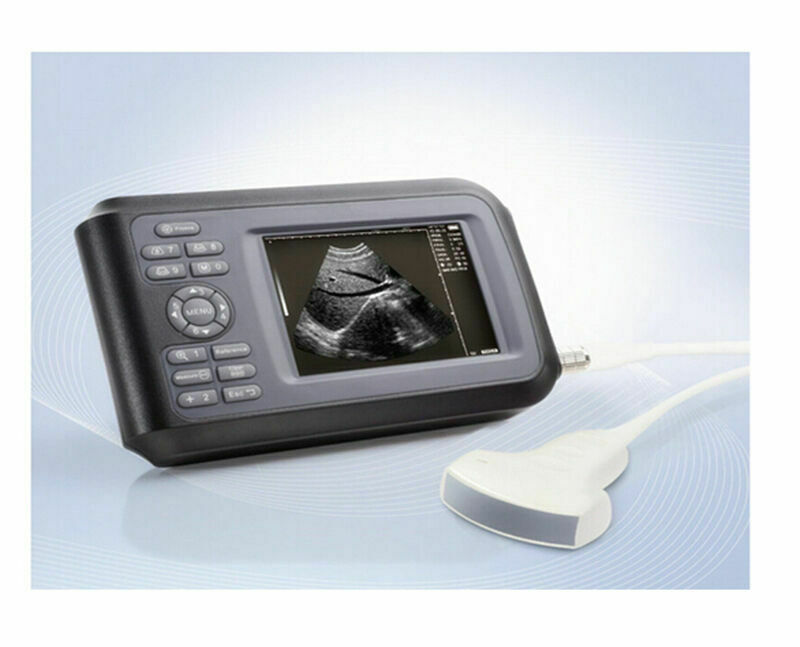 Portable Handheld Ultrasound Scanner Machine Digital+Convex Probe For Human US DIAGNOSTIC ULTRASOUND MACHINES FOR SALE