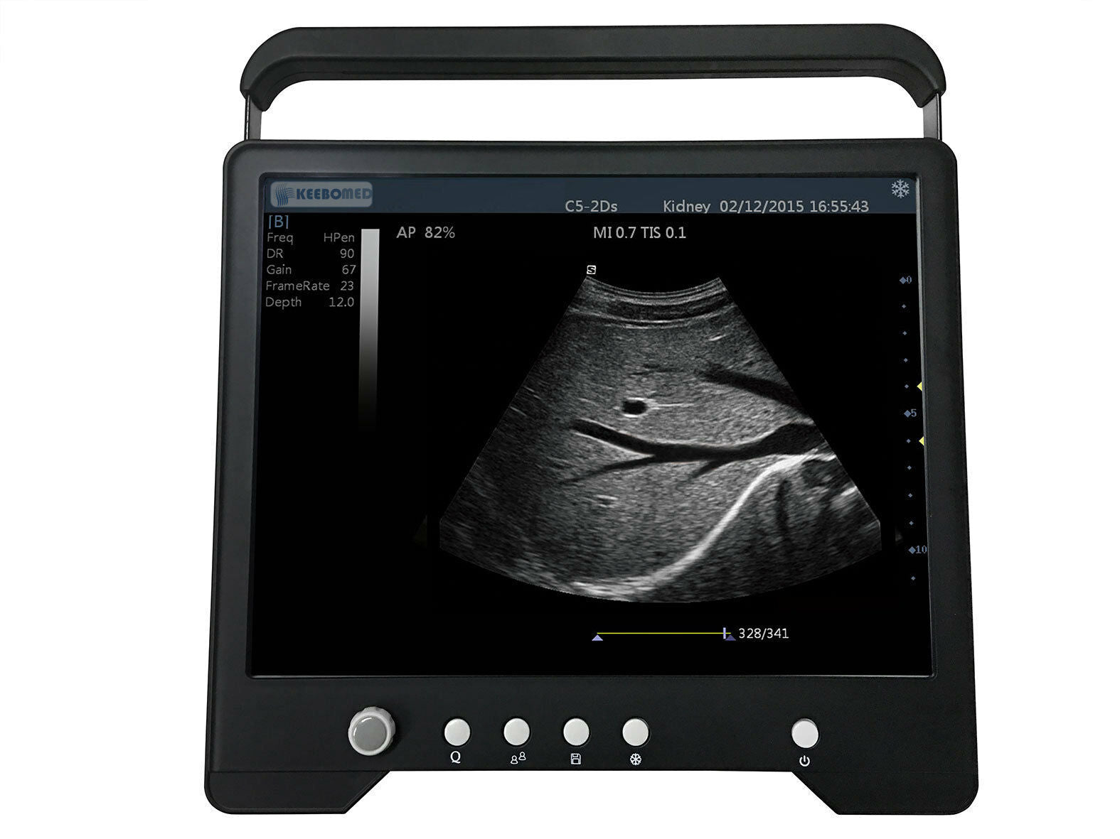 Veterinary Sheep, Goats, Pigs, Touch Screen Ultrasound & Convex Probe | KeeboMed DIAGNOSTIC ULTRASOUND MACHINES FOR SALE