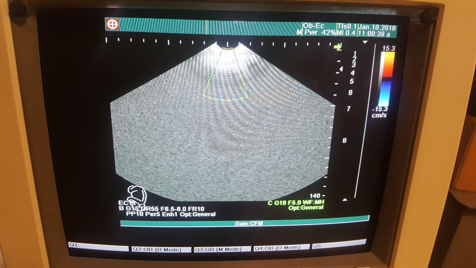 Shimadzu SDU-1200Pro Diagnostic Ultrasound unit 541-50049-03 OB, GYN, DIAGNOSTIC ULTRASOUND MACHINES FOR SALE