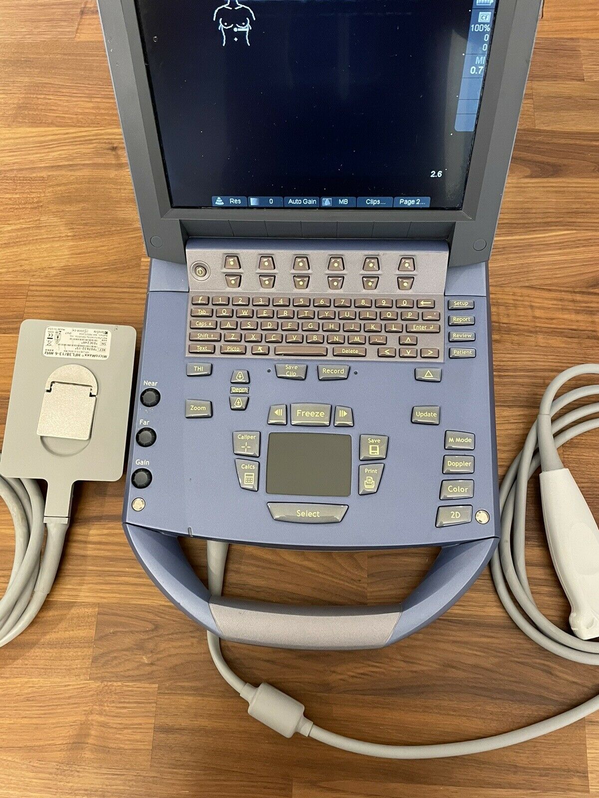 SONOSITE MICROMAXX 2008 CW DOPPLER W/ 2 Probes PORTABLE ULTRASOUND DIAGNOSTIC ULTRASOUND MACHINES FOR SALE