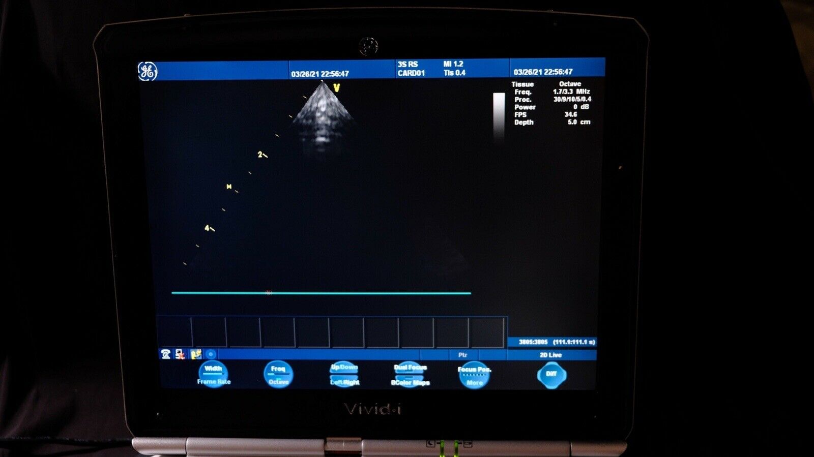 GE Logiq E Ultrasound System Version 5.. With CW option. Sector 3srs DIAGNOSTIC ULTRASOUND MACHINES FOR SALE