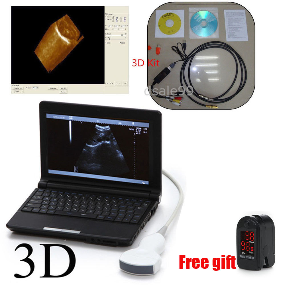 Portable Laptop Ultrasound Scanner Diagnostic machine Convex Probe 3D OximeterAA 190891895424 DIAGNOSTIC ULTRASOUND MACHINES FOR SALE