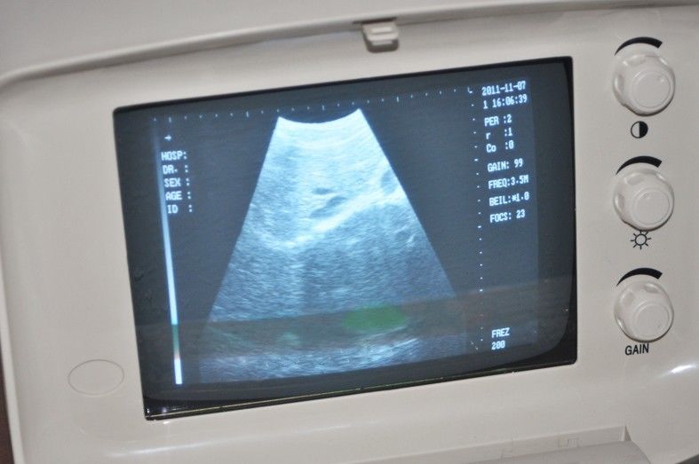 Sale Portable Type-B Ultrasonic Ultrasound Scanner Micro-Convex Probe/sensor 3D 190891653642 DIAGNOSTIC ULTRASOUND MACHINES FOR SALE