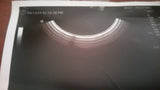GE  E8C  Ultrasound Transducer Probe
