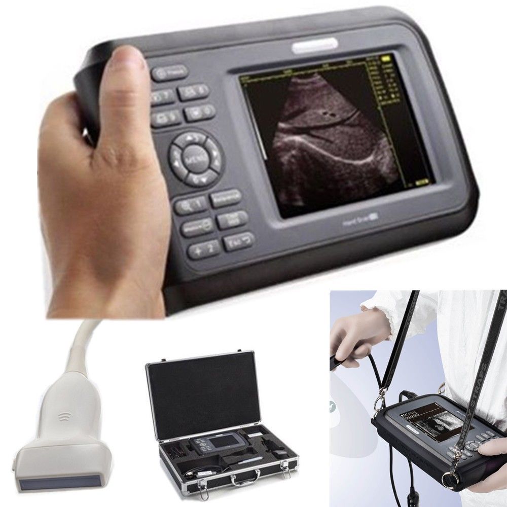 Laptop HandScan Digital Ultrasound Scanner system 7.5Mhz  Linear Probe + Case 190891758767 DIAGNOSTIC ULTRASOUND MACHINES FOR SALE