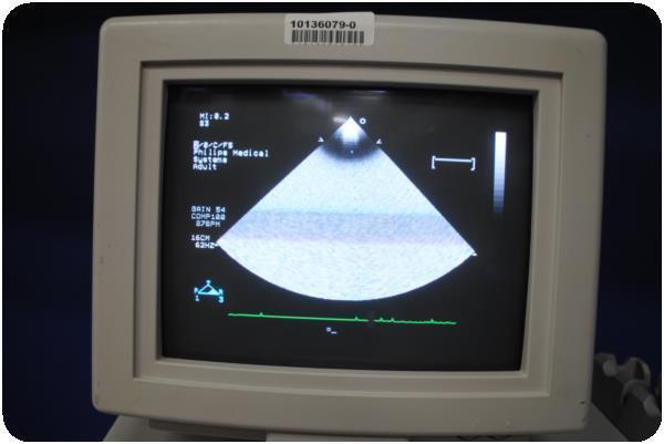 ultrasound monitor 2