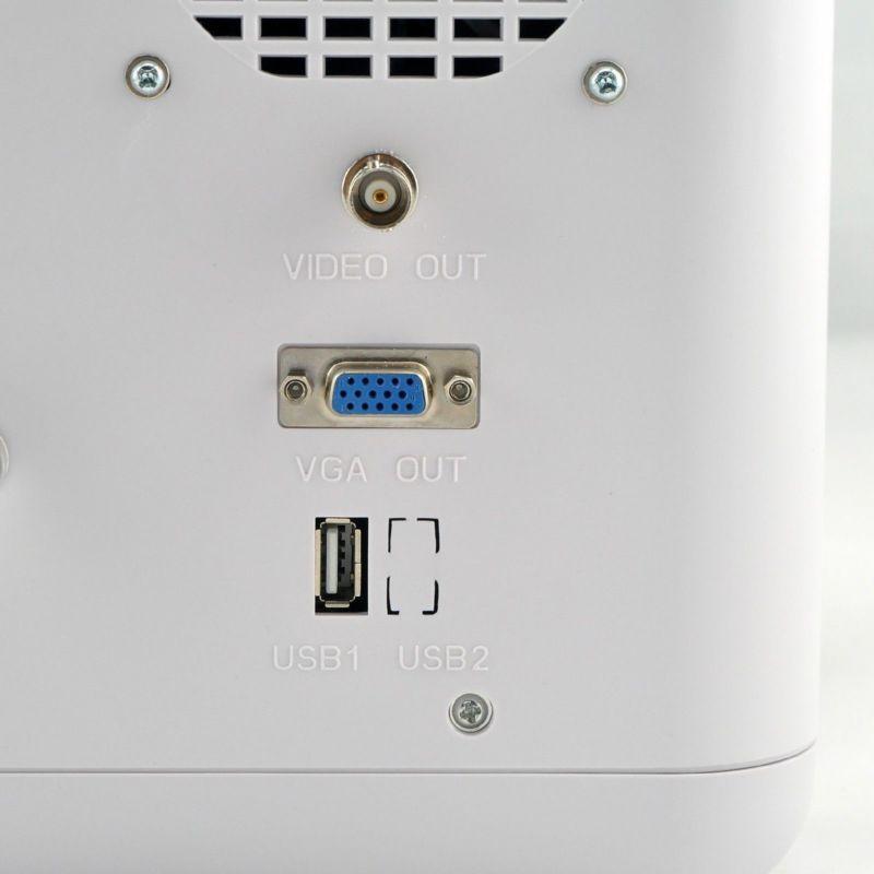 Sale 12 inch Ultrasound Scanner Digital Machine+Convex &Linear 2 Probes+3D Image 190891926722 DIAGNOSTIC ULTRASOUND MACHINES FOR SALE