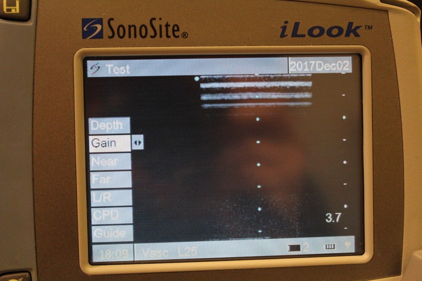 Sonosite i-Look 25 portable ultrasound DIAGNOSTIC ULTRASOUND MACHINES FOR SALE