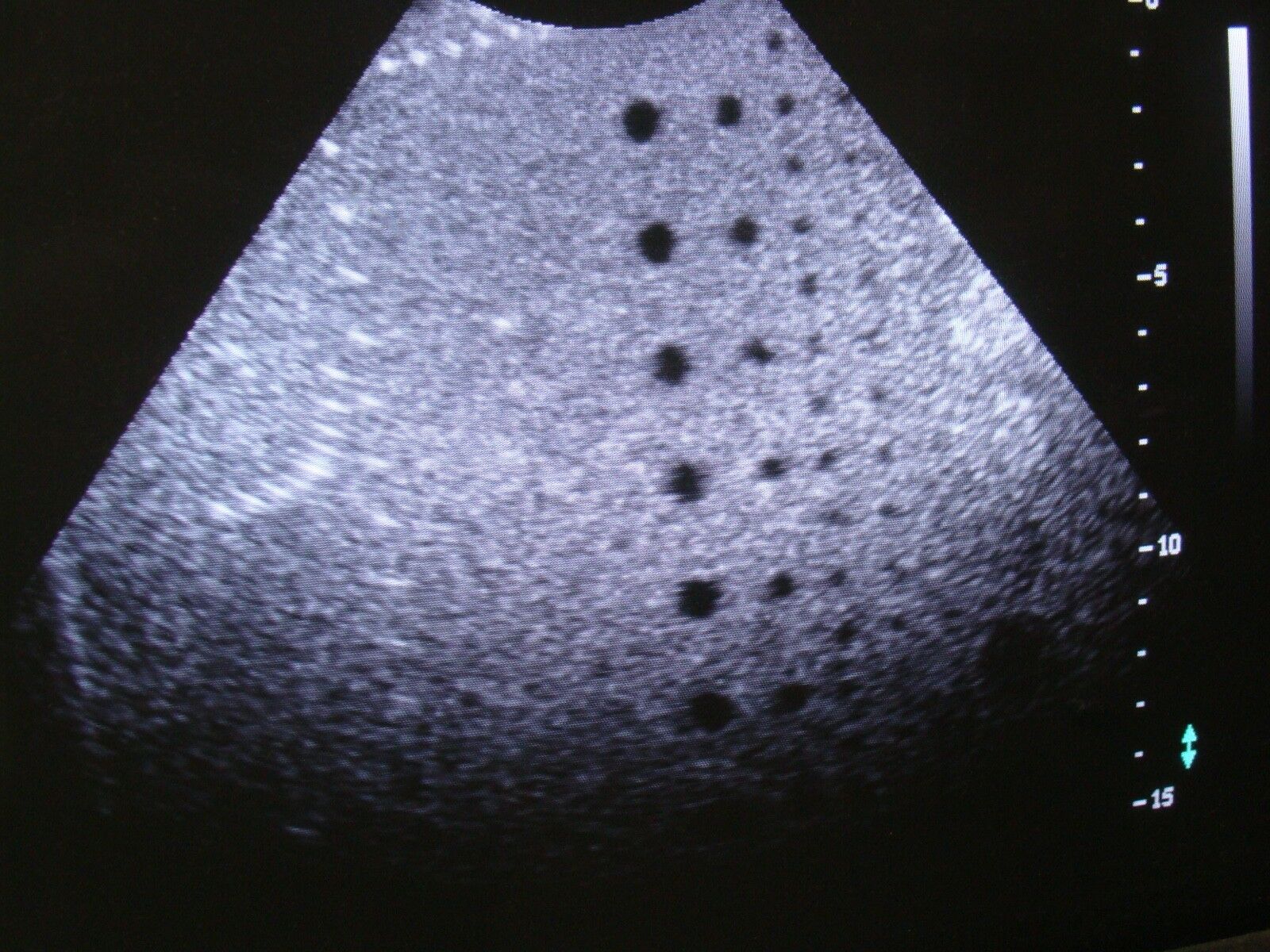 C5-2 CURVED ARRAY TRANSDUCER PROBE 40R FOR ATL HDI 5000 SONOCT ULTRASOUND SYSTEM DIAGNOSTIC ULTRASOUND MACHINES FOR SALE