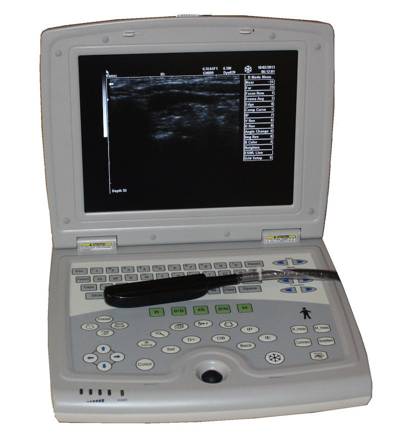 Portable Digital Ultrasound Device, Farm Animals-Equine Bovine KeeboMed KX5000KV DIAGNOSTIC ULTRASOUND MACHINES FOR SALE