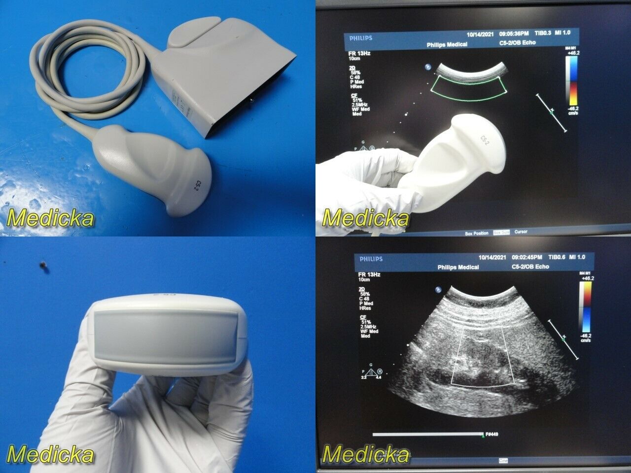 Philips C5-2 Convex Array Ultrasound Transducer Probe *TESTED & WORKING* ~ 26342 DIAGNOSTIC ULTRASOUND MACHINES FOR SALE