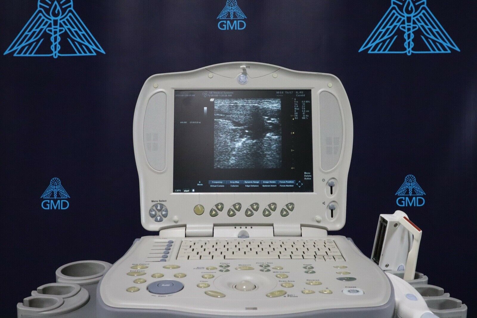 GE LOGIQ BOOK XP PORTABLE ULTRASOUND DIAGNOSTIC ULTRASOUND MACHINES FOR SALE