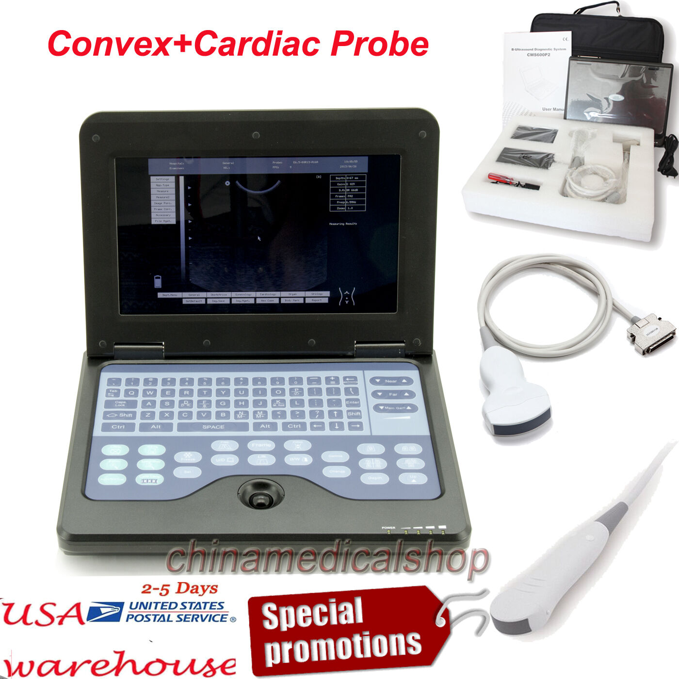 With Convex &Cardiac Sensors Digital Ultrasound Scanner Ultrasonic Machine USA DIAGNOSTIC ULTRASOUND MACHINES FOR SALE