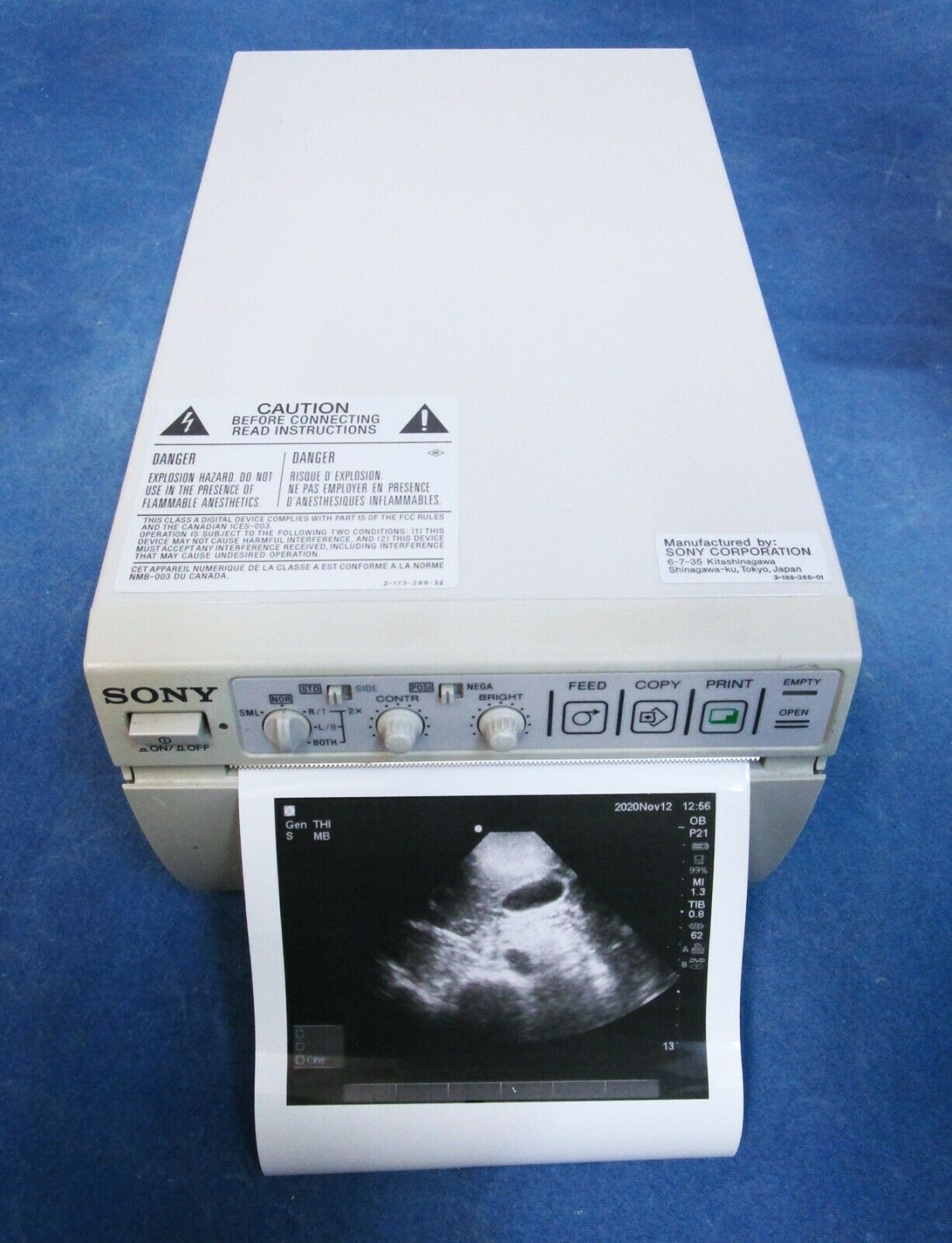 Sonosite M-Turbo Ultrasound System Complete - 60 Day Warranty DIAGNOSTIC ULTRASOUND MACHINES FOR SALE