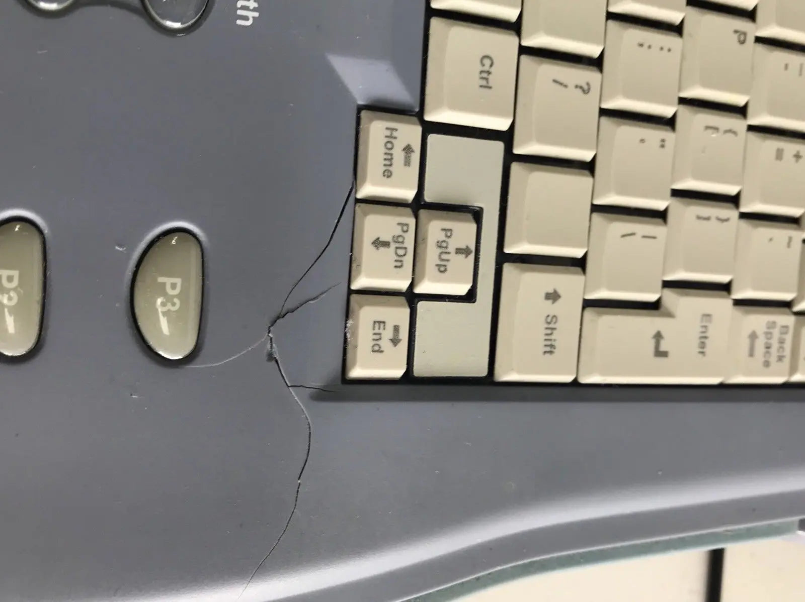 GE Logiq Book XP with 2 x Ultrasound Probes. Linear and Convex 2011 DIAGNOSTIC ULTRASOUND MACHINES FOR SALE