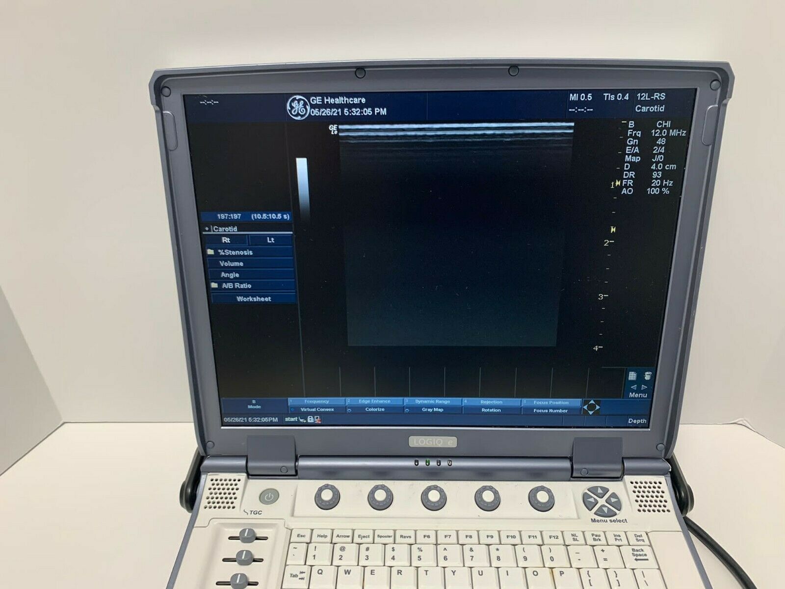 GE Logiq e Portable Ultrasound Machine System With 12L-RS DIAGNOSTIC ULTRASOUND MACHINES FOR SALE