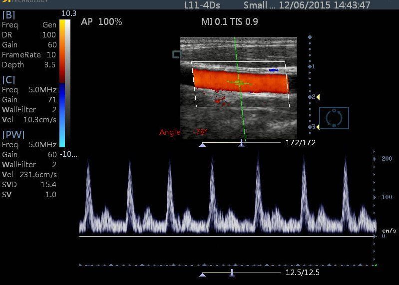 Veterinary Color Doppler Touch Screen Ultrasound 15"  with Linear Array Probe DIAGNOSTIC ULTRASOUND MACHINES FOR SALE