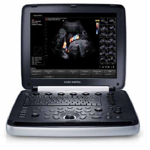 SAMSUNG MEDISON UGEO HM70A - THREE PROBES - DIAGNOSTIC ULTRASOUND MACHINES FOR SALE