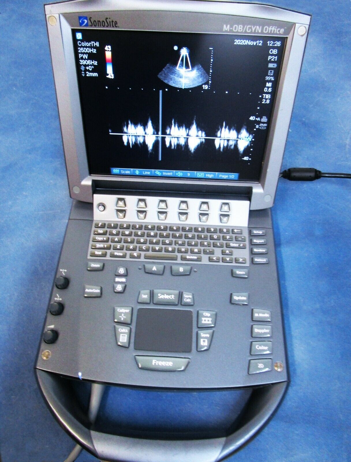 Sonosite M-Turbo Ultrasound System Complete - 60 Day Warranty DIAGNOSTIC ULTRASOUND MACHINES FOR SALE