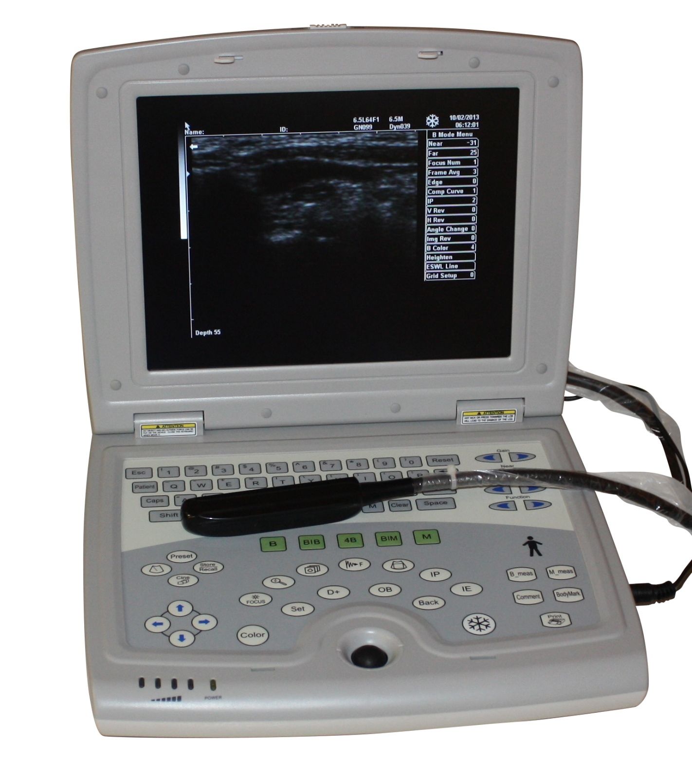 Veterinary Laptop Ultrasound Scanner 10" LCD & Rectal Probe - USA Warranty Deal DIAGNOSTIC ULTRASOUND MACHINES FOR SALE